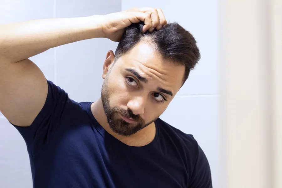 Hair-Loss-Doctor A man in a navy t-shirt looks in the mirror worrying about and touching his receding hairline, considering hair loss and restoration treatment from ProCare Wellness Institute in Savannah.