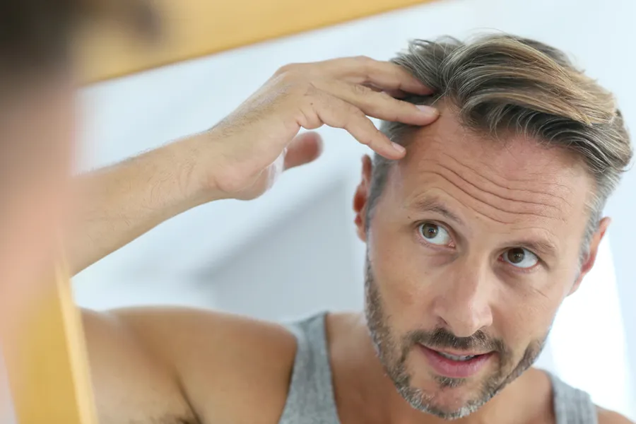 Peptides-for-Hair-Restoration-Doctor A middle-aged man with blonde and gray hair inspects his receding hairline in the mirror, considering getting peptides for hair restoration treatments from ProCare Wellness Institute in Savannah.